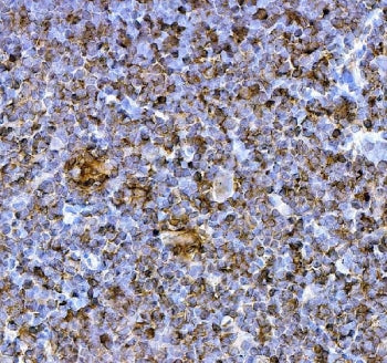 Pdcd1 Antibody / Pd1