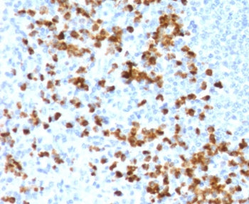 MMP9 Antibody / Matrix metalloproteinase-9