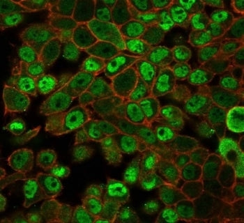 Immunofluorescent staining of PFA-fixed human HeLa cells using JAZF1 antibody (green, clone PCRP-JAZ