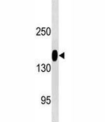 CD13 Antibody (ANPEP)