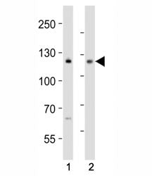 Western blot analysis of lysate from (1) MCF-7 and (2) Jurkat cell line using NOTCH antibody at 1:10