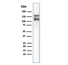 MSH6 Antibody