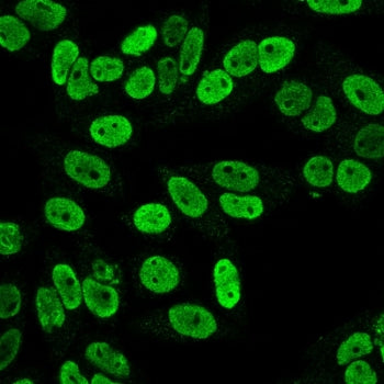 Cyclin B1 Antibody / CCNB1