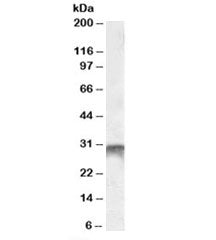 Western blot testing of human bone marrow lysate with DLX5 antibody at 1ug/ml. Predicted molecular w