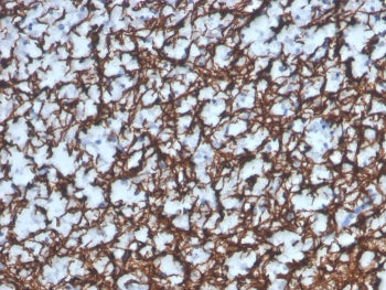 IHC staining of FFPE human brain with recombinant Myelin Basic Protein antibody (clone MBP/4277R). H