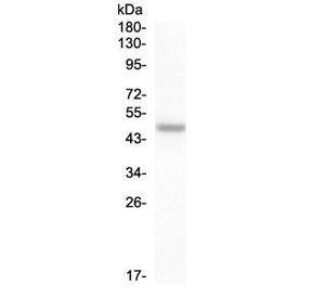 Western blot testing of human SW579 cell lysate with PAX8 antibody at 0.5ug/ml. Predicted molecular 