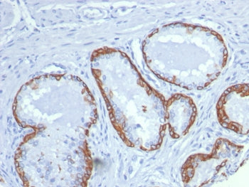 Cytokeratin 14 Antibody / CK14 / KRT14