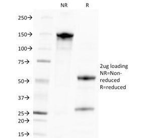 SDS-PAGE Analysis of Purified, BSA-Free CMV Antibody (clone CMV100). Confirmation of Integrity and P