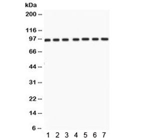 p95 NBS1 Antibody