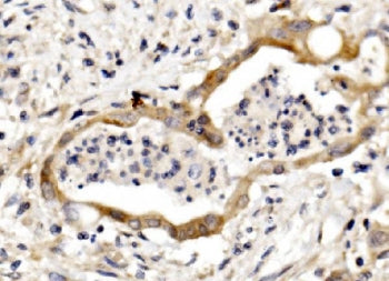 NECTIN3 Antibody / Nectin 3