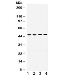 Western blot testing of human 1) MCF7, 2) HeLa, 3) 22RV1 and 4) SW620 cell lysate with Thrombin Rece