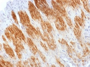 IHC testing of FFPE rat uterus stained with Calponin antibody. HIER: steam sections in 10mM Tris wit