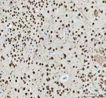 NOVA1 Antibody