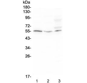 Chemokine Receptor D6 Antibody / ACKR2