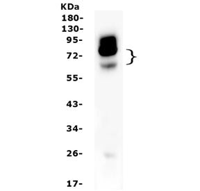 Western blot testing of NOX4 antibody and rat kidney lysate. Expected molecular weight: ~65 kDa, 75-