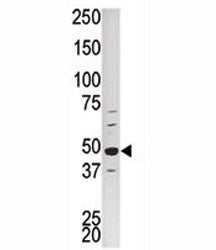 PCTAIRE1 Antibody (PCTK1)