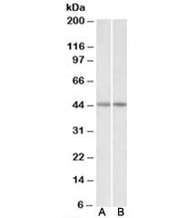 CKM Antibody