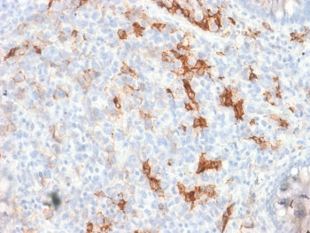 NGF Receptor Antibody / p75NTR / CD271