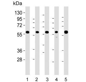 PPP2R1B Antibody