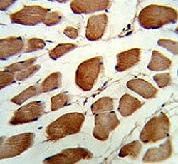 GSTO1 Antibody