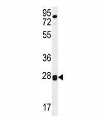 TOR2A Antibody