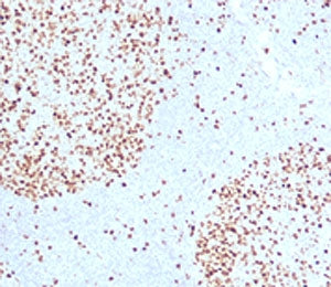 Topoisomerase II alpha Antibody / TOP2A