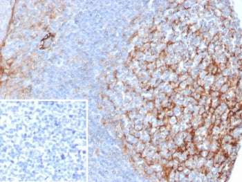 ICAM1 Antibody / CD54