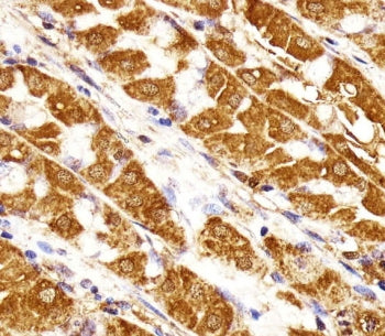 MORC3 Antibody / Nuclear matrix protein 2 / NXP2