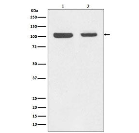 Retinoblastoma Antibody / Rb1