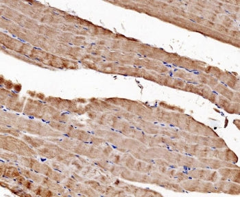 CACNA1S Antibody