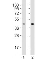 AGXT Antibody
