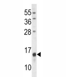 Osteocalcin Antibody