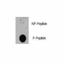 TSC1 Antibody (phospho-S505)