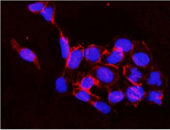 IKKb Antibody