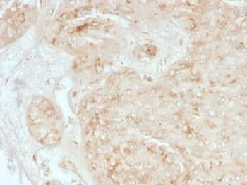 StAR Antibody / Steroidogenic acute regulatory protein