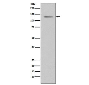 Progesterone Receptor Antibody