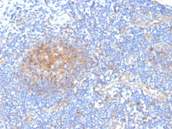 IHC staining of FFPE human tonsil with ARK1C1 antibody. HIER: boil tissue sections in pH 9 10mM Tris