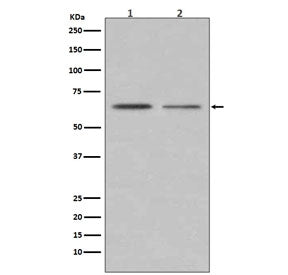 Estrogen Receptor alpha Antibody