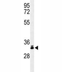 Western blot analysis of DKK-1 antibody and T47D lysate. Predicted molecular weight: 26-40 kDa depen