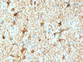 IHC testing of FFPE human cerebellum tissue with recombinant GFAP antibody (clone GFA12-4R). Require