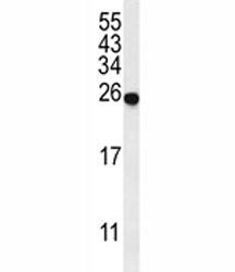 Western blot analysis of SPR antibody and mouse liver tissue lysate. Predicted molecular weight ~28 