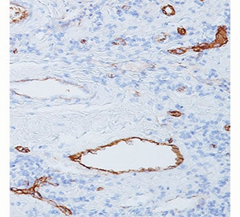 von Willebrand Factor Antibody / vWF