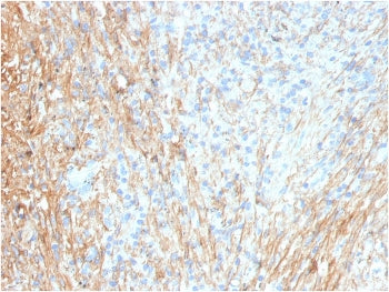 IHC staining of FFPE human lung with Fibronectin antibody (clone FN1/3036). HIER: boil tissue sectio