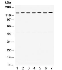 Western blot testing of 1) rat brain, 2) rat liver, 3) rat testis, 4) human HeLa, 5) human A549, 6) 