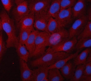 Immunofluorescent staining of FFPE human PC-3 cells with Alpha Taxilin antibody (red) and DAPI nucle