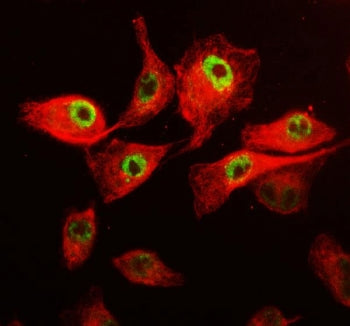 Immunofluorescent staining of FFPE human A549 cells with CDK12 antibody (green) and Beta Tubulin mAb (red). HIER: steam section in pH6 citrate buffer for 20 min.
