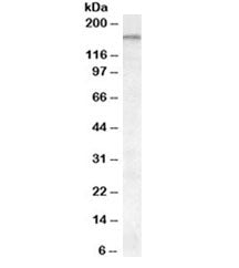 Western blot testing of cerebellum lysate with ABCA9 antibody at 0.1ug/ml. Predicted molecular weigh