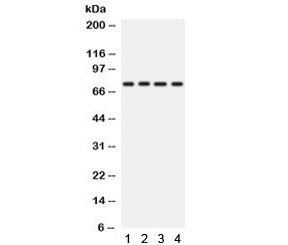 Western blot testing of human 1) A431, 2) A549, 3) HeLa and 4) SKOV lysate with PKC eta antibody. Pr