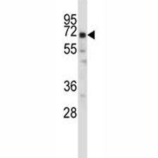 Oct-2 antibody western blot analysis in ZR-75-1 lysate. Predicted molecular weight: isoforms 1-5 ran