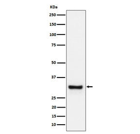 Western blot testing of human plasma cell lysate with ADIPOQ antibody. Predicted molecular weight ~3